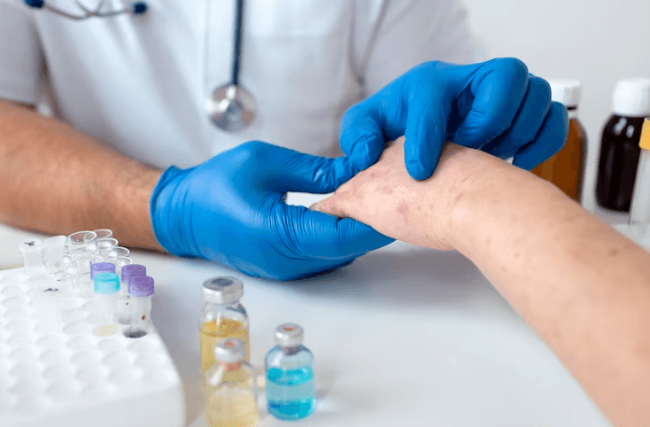 Karantina Sumsel Perketat Pengawasan Hewan Masuk untuk Hindari Cacar Monyet