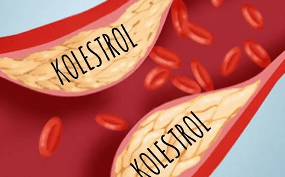 Tips Makan Daging Kurban Tanpa Takut Kolesterol Naik, Ini Cara Aman Konsumsinya